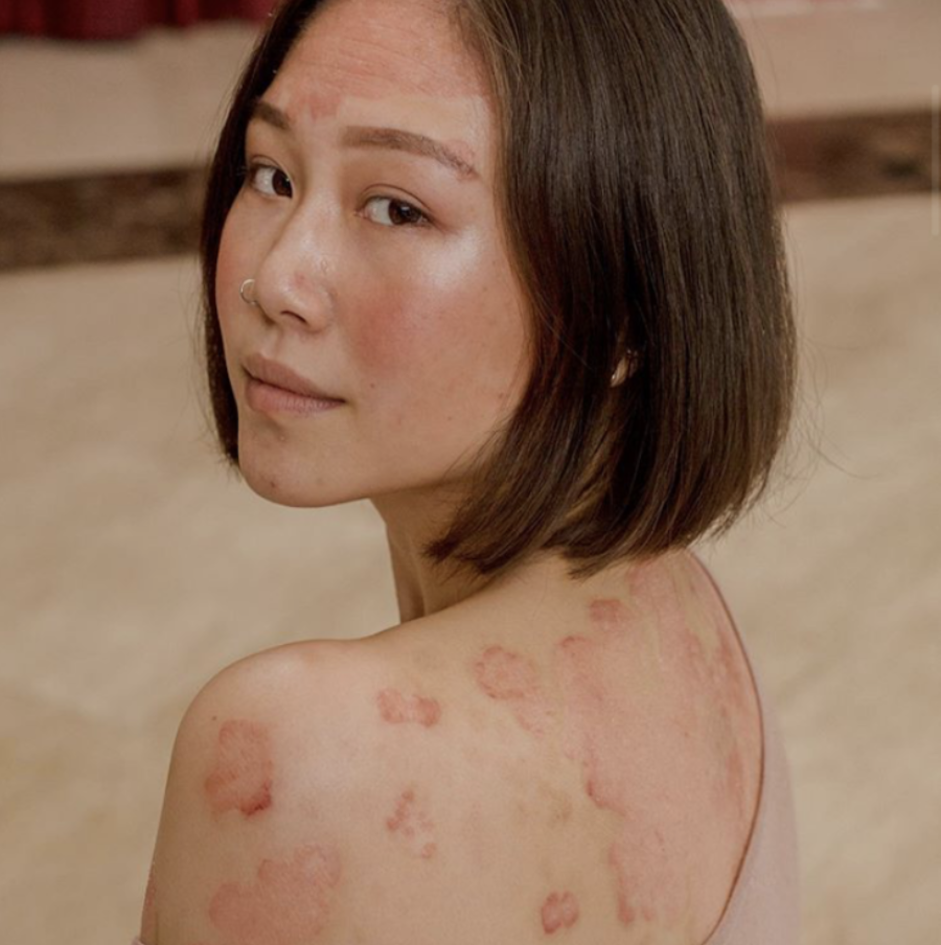 Celebrating your skin example photo