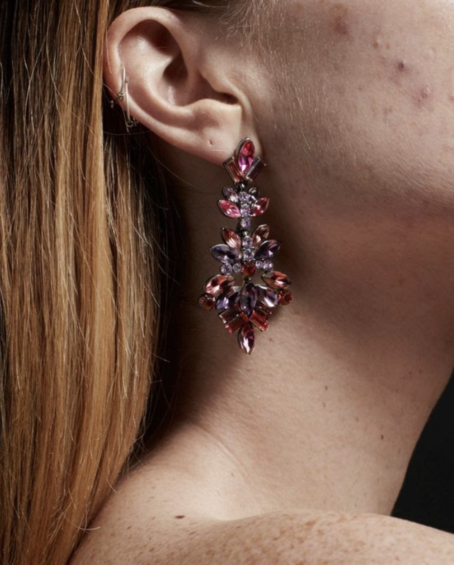 Celebrating your skin example photo